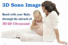 3D Ultrasound  Sono Image image 5