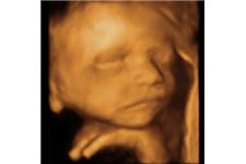 Baby in Sight 3D/4D Fetal Ultrasound image 2