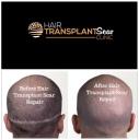 Hair Transplant Scar Clinic logo