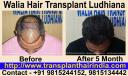 Walia Hair Transplant Ludhiana India logo