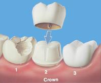 Mint Dental Clinic image 1