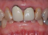 Mint Dental Clinic image 4