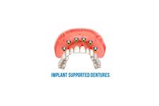 Implants Dentist image 4