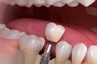 Stittsville Dentist – Dental Clinic image 2