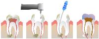 Vista Dental & Denture Clinic image 2