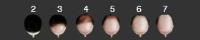 Get the best hair transplant cost in Toronto! image 1