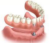 Synergy Denture Clinic image 1