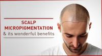 Affordable Scalp Micropigmentation image 1