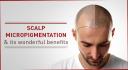 Affordable Scalp Micropigmentation logo