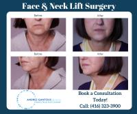 Toronto Facial Plastic Surgery image 6