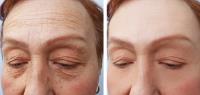 Oakville Cosmetics - Botox + Dermal Fillers image 4