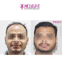 Medispa Hair Transplant Clinic image 2