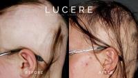 Lucere Dermatology & Laser Clinic image 2