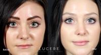 Lucere Dermatology & Laser Clinic image 11