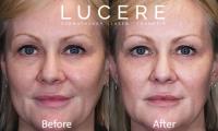 Lucere Dermatology & Laser Clinic image 6