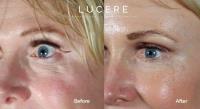 Lucere Dermatology & Laser Clinic image 7