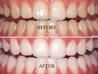 dental & smile design at MAHOGANY image 2