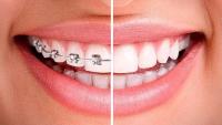 dental & smile design at MAHOGANY image 6