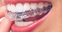 dental & smile design at MAHOGANY image 9