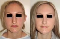 Dr. Andrew B. Denton Facial Plastic Surgeon image 4