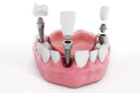 Sandstone Dental image 5