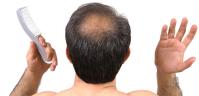 The Hair Loss Recovery Program  image 16