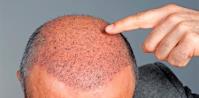The Hair Loss Recovery Program  image 15