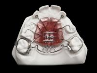 Creative Designs Orthodontic Studio image 12