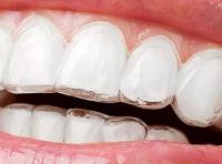 Toothlight Dental image 4