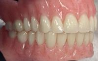 North East Denture Clinic image 4