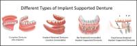 North East Denture Clinic image 2