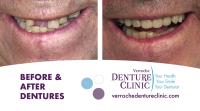 Denture Clinic St. Catharines image 2