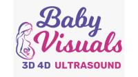 3D/4D Baby Visuals Ultrasound  image 1