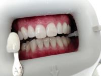 Zoom Dental Burnaby image 2