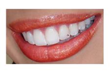 Pam Elliott at Simcoe Muskoka Dental Hygiene image 1