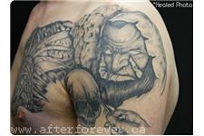 After Forever Tattoo & Laser Tattoo Removal image 3
