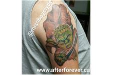 After Forever Tattoo & Laser Tattoo Removal image 8