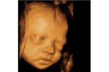 Baby in Sight 3D/4D Fetal Ultrasound image 6