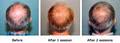 Cole Clinic Hair Restoration & Medispa image 5