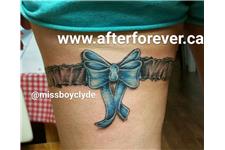 After Forever Tattoo & Laser Tattoo Removal image 10