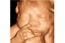 3D Ultrasound  Sono Image image 6