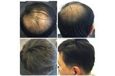 Pacific Hair Extensions and Hair Loss Solutions image 4
