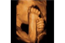 Baby in Sight 3D/4D Fetal Ultrasound image 4