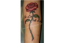 After Forever Tattoo & Laser Tattoo Removal image 5