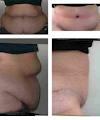 The Mississauga Cosmetic Surgery & Laser Clinic image 4