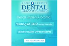Bond Street Dental Implants Toronto image 1