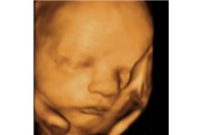 Baby in Sight 3D/4D Fetal Ultrasound image 5