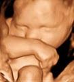 3D Ultrasound  Sono Image image 1