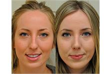 REVESSE - Rhinoplasty and Facial Cosmetic Surgery image 1