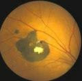 Mississauga Optometrist | Your Vision image 4